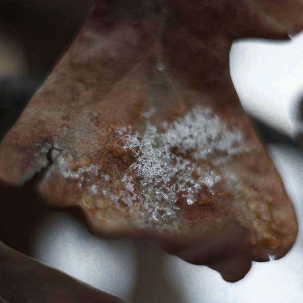 Hoja seca con liquen blanco